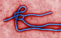 [포토] 에볼라 바이러스의 모습