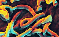 美 에볼라 사태에 테크미라 주가 폭등