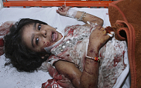 [포토]파키스탄 자폭테러, 피투성이가 된 아이