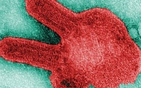 마버그열이란 에볼라 증상과 유사…최근 우간다서 발생 '충격'