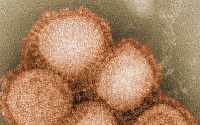 신종플루 첫 지역사회 감염 발생