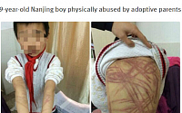 [포토] 양부모에게 학대당한 9살 소년