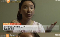 ‘리얼스토리 눈’ 원정 성형수술 중국女 “동의 없이 갈비뼈 빼 코 이식” 충격 피해