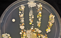 [포토] 메르스 예방, 손 씻어야 하는 이유를 보여주는 사진
