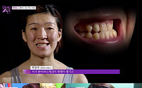 JTBC 화이트 스완 김선화, “턱 근육이 찢어지는 고통… 정말 힘들었다”