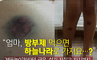 [카드뉴스 팡팡]"체포놀이하자"동급생들에 보복폭행 당해…온 몸에 피멍