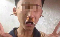 [포토] 친구 귀와 코에 담배 꽂은 뒤 사진 찍은 14살 소년들