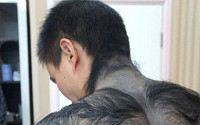 [포토] 등이 털로 뒤덮여…'늑대인간'으로 변해버린 남성