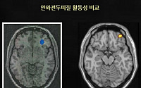 인터넷 게임 중독, 마약중독과 유사한 뇌구조 확인