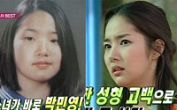 '리멤버' 박민영, 성형 전 과거모습 보니 '지금과 사뭇 다른 미모'