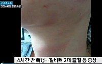 조선대 의전원 폭행남…감금죄 추가 검찰 약식기소