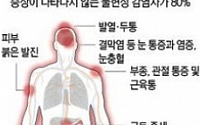 소두증 유발 지카바이러스 동아시아 창궐…성관계로도 감염