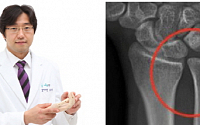 손목 ‘시큰’ 삼각섬유연골파열을 동반하는 척골충돌증후군