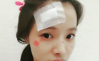 윤소이, SNS에 부상 당한 사진 게재…“궁금하시면 ‘그래 그런거야’에서 확인 좀”