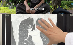 이혜영, '폐암' 6년 투병 마침표⋯"완치 아닌 졸업"