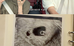 전진♥류이서, 시험관 임신 성공했지만⋯7주 만에 유산 “다시 도전할 것”