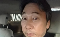 이문세, 백내장·노안 수술 후 아내에 "당신이 이렇게 예뻤구나"