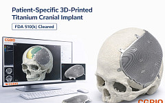 시지바이오, 환자맞춤형 티타늄 임플란트 ‘이지메이드 TI’ 美 FDA 허가