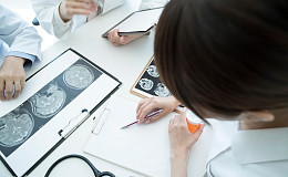 알츠하이머 치료제 레캠비, 중국서 접근성 확대 '파란불'