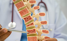 '사과 하나만 먹기?' 급격한 다이어트, 중장년 뼈 ‘경고등’