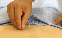 요추 협착증 한방 치료로 수술ㆍ마약성 진통제 줄어