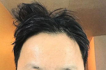 '혈액암 투병' 조수원, '부코페' 참석 위해 치료 집중…