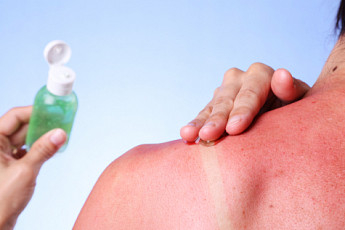 가렵고 따가운 여름 피부질환, 심하면 쇼크까지?