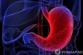 부모·형제 모두 위암이면 발병률 두 배 이상 증가