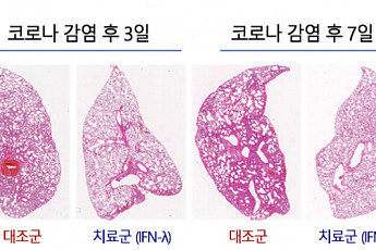 코로나·폐렴 완화하는 ‘흡입형 치료제’ 개발 길 열려