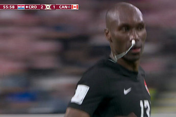 [카타르 월드컵] 노장의 코에 꽂힌 여성용품…캐나다 ‘이색 응급처치’ 화제