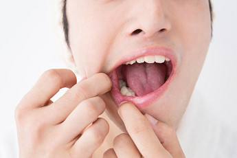 면역력 떨어지면 찾아오는 구내염…환절기 더욱 주의