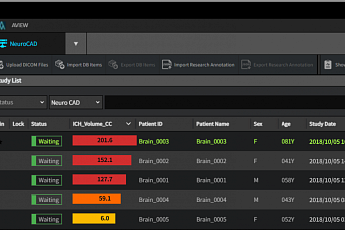 코어라인소프트, AI 의료 솔루션 'AVIEW Neuro CAD' 비급여 청구 시작