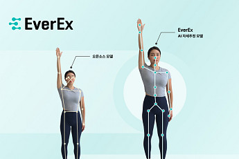 에버엑스, AI 근골격계 분석 의료기기 개발‧공급과제 정부 지원 사업 선정