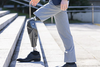 다리 절단 유학생이 개발한 로봇의족, CES 최고혁신상에 [피플]