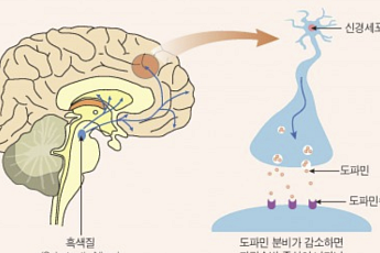 이유 없이 손 떨린다면 ‘이 질환’ 의심해야 [e건강~쏙]