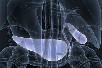 진단·수술 어려운 ‘담관암’ 어떻게 관리하나 [e건강~쏙]