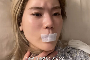 '씨야' 김연지, 성대 낭종 판정⋯목소리 잃은 4주 