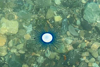 제주도 휴가객 경악...해파리피부염 등 주의보