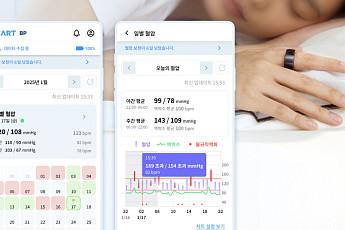'손에 쏙!' 반지로 혈압 체크 ‘카트 비피’ 출시