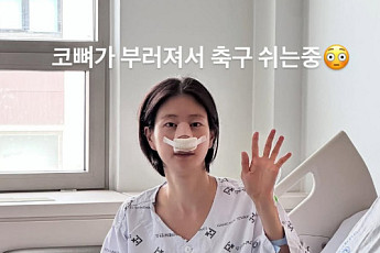 이현이, 프로 선수 못지 않은 열정⋯축구 경기 중 코뼈 골절 