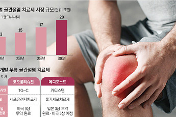‘근본적 치료제’ 없는 무릎 골관절염, K바이오가 제패할까
