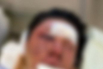 “귀에 피가 고여 안 들릴 정도”...수탉 피해 사건 직접 입 열었다