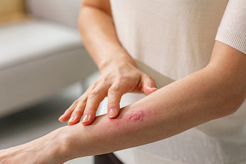 한국GSK, ‘대상포진 행동 주간’ 맞아 글로벌 인식 조사 결과 공유