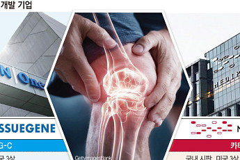 글로벌 시장 노리는 K-관절염 신약들…FDA 문턱 넘을까