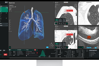 코어라인소프트, 호주 NLCSP 레퍼런스 확대⋯“구조적 성장 진입”