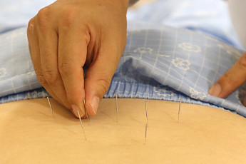 요추 협착증 한방 치료로 수술ㆍ마약성 진통제 줄어