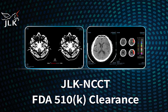 제이엘케이, 비조영 CT 기반 뇌졸중 분석 솔루션 美 FDA 510k 획득