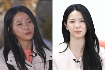 '나솔' 30기 영자, 방송 후 성형 시술 고백⋯