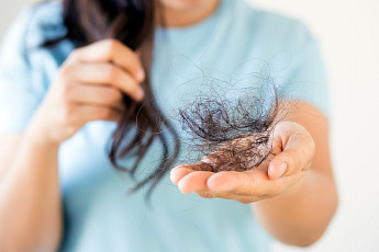 ‘고함량 비오틴’ 젤리로 진화⋯탈모 건기식도 ‘제형 혁신’