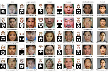 서울대병원, 인종 편향 없앤 의료용 안면 익명화 AI ‘FairAnon’개발